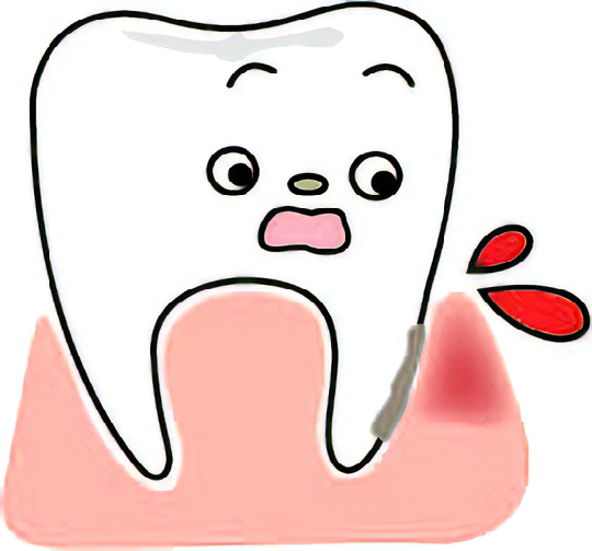 歯肉炎・歯周炎のイメージ